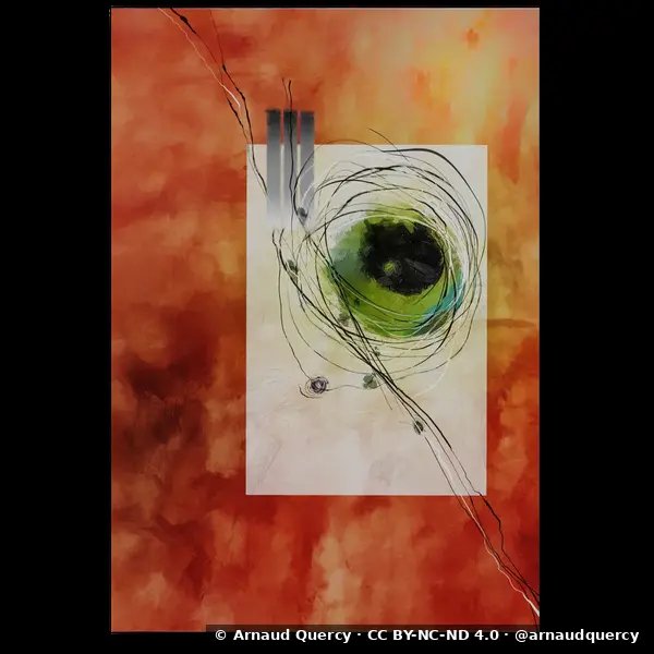 Eye